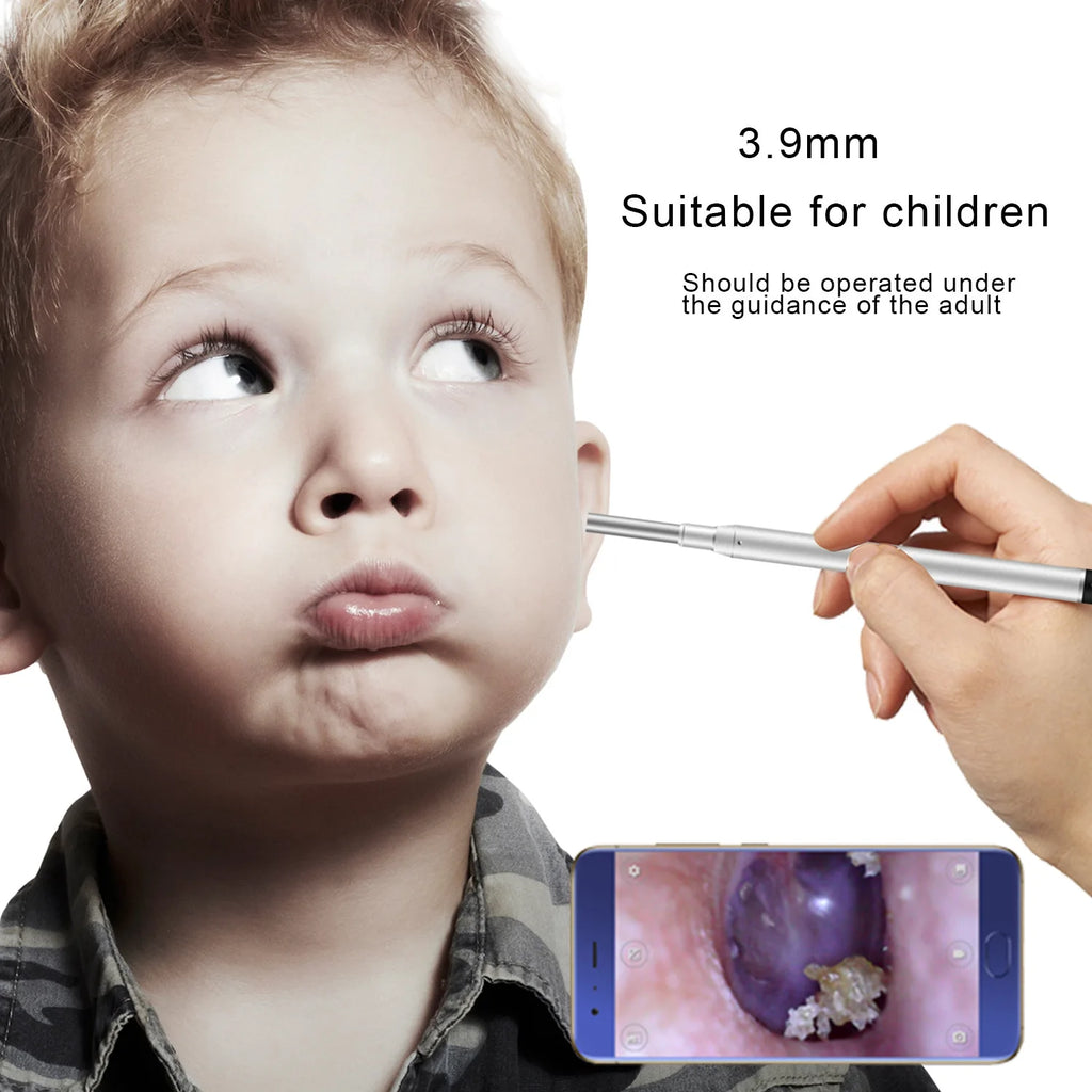 E10 Endoscope Camera